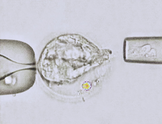 囊胚细胞