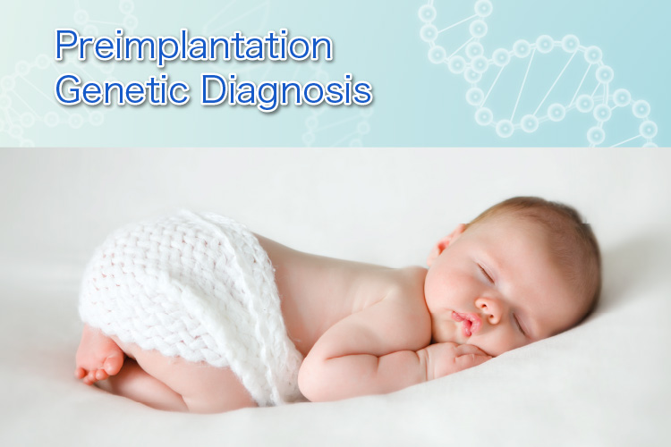 Preimplantation Genetic Diagnosis; PGD