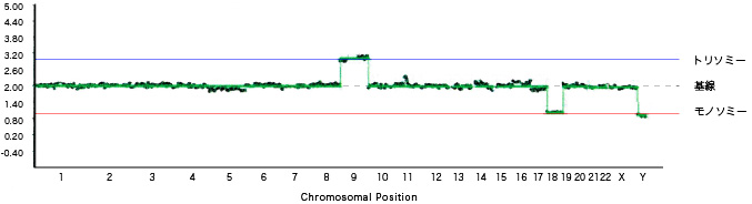 「グラフ2」9トリソミー、18モノソミー、性染色体異常（XXY）
