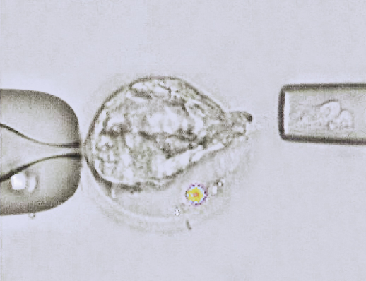 Blastocyst
